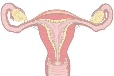 Evde menstruasyon kanaması nasıl durdurulur?
